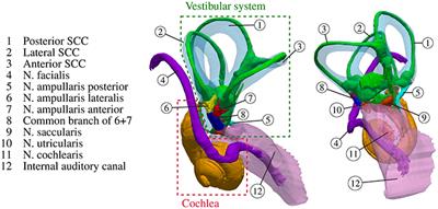 Model-based Vestibular Afferent Stimulation: Modular Workflow for Analyzing Stimulation Scenarios in Patient Specific and Statistical Vestibular Anatomy